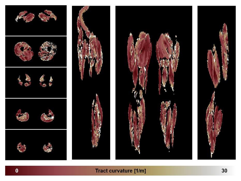 Muscle fiber tract curvature map based on whole leg DTI based fiber tractography.