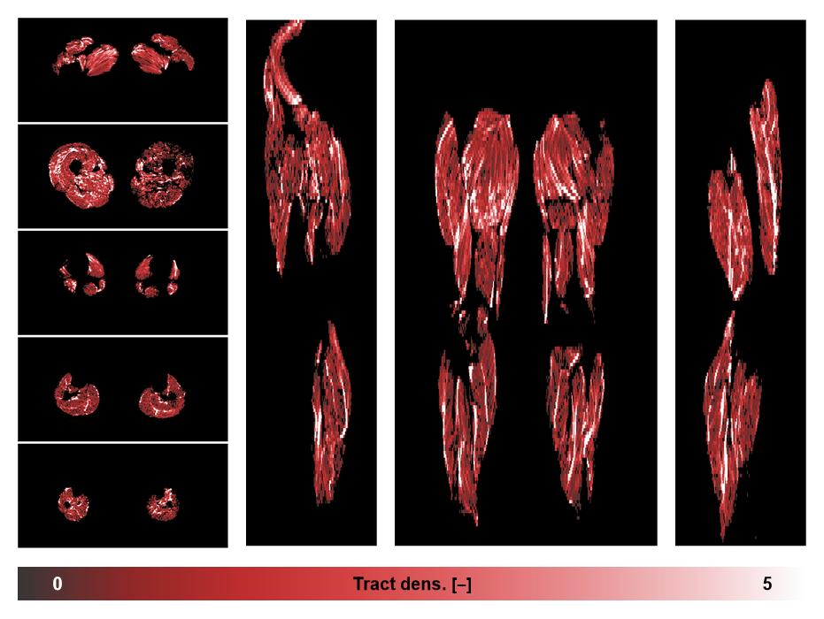 Muscle fiber tract density map based on whole leg DTI based fiber tractography.