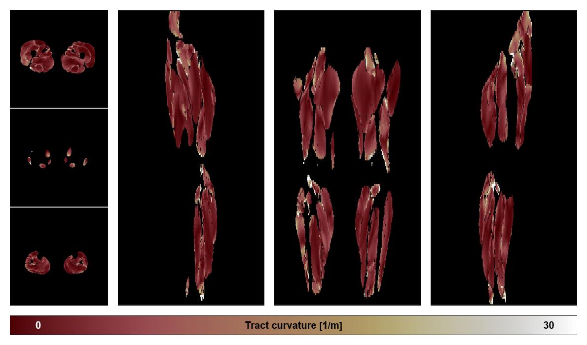 Muscle fiber tract curvature map based on whole leg DTI based fiber tractography.