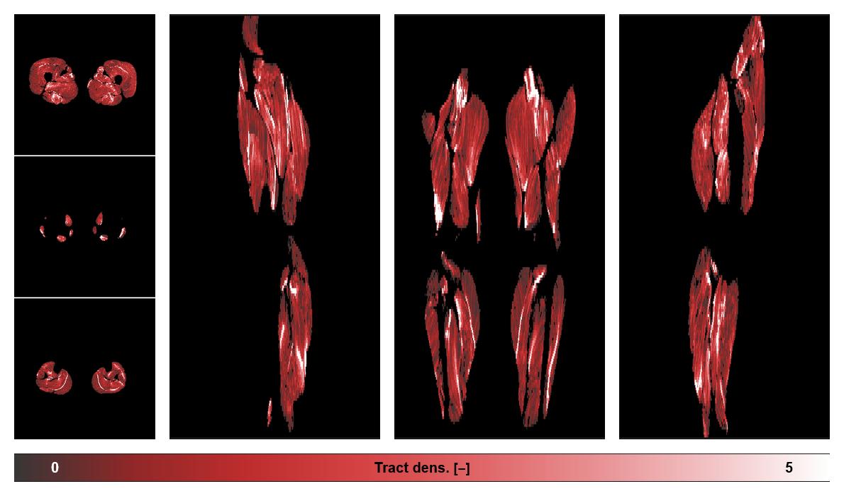 Muscle fiber tract density map based on whole leg DTI based fiber tractography.