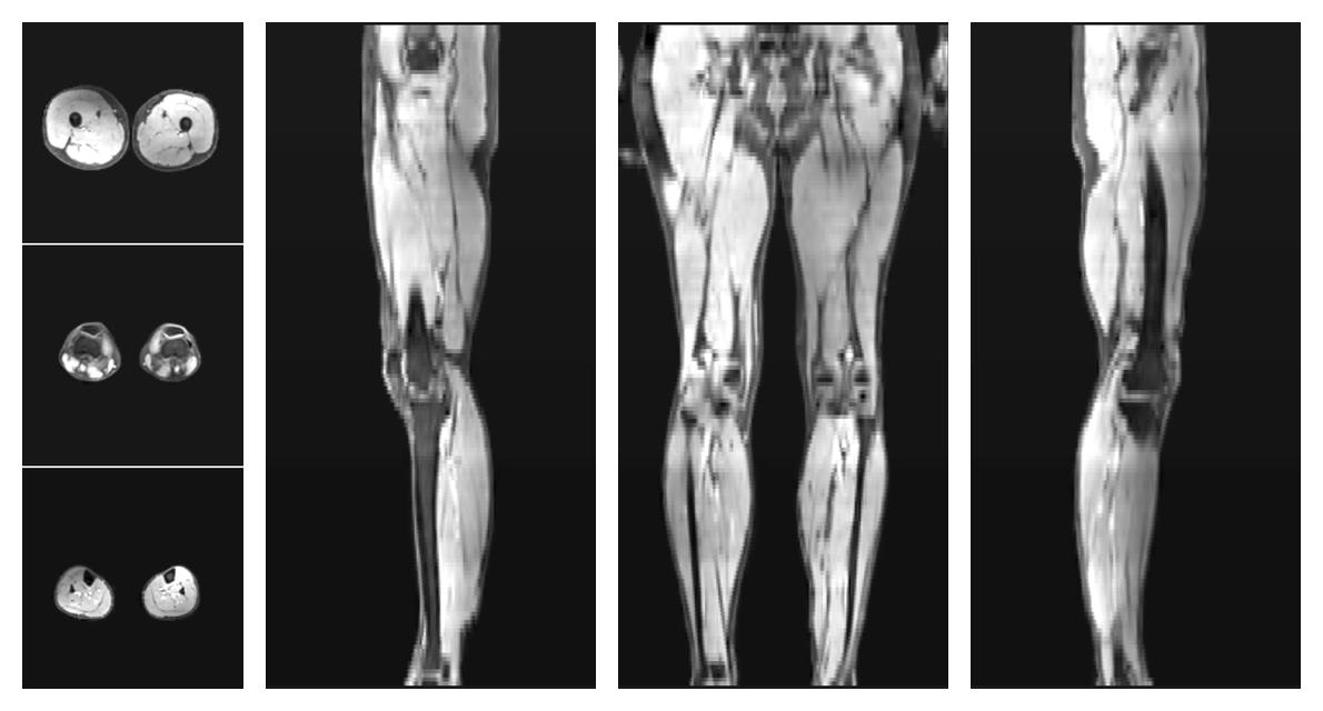 The water part of the acquired multi-echo spin echo data.
