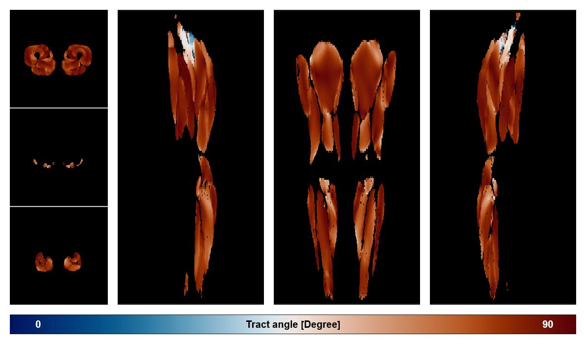 Muscle fiber tract angle map based on whole leg DTI based fiber tractography.