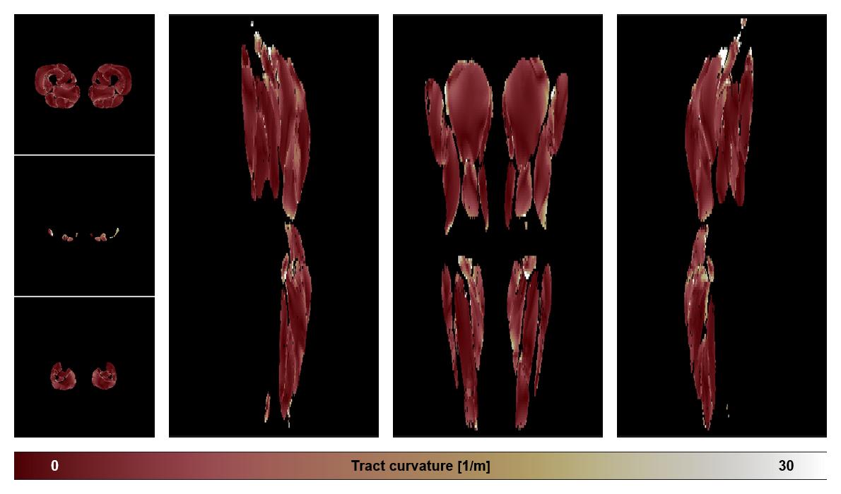 Muscle fiber tract curvature map based on whole leg DTI based fiber tractography.