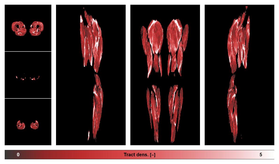Muscle fiber tract density map based on whole leg DTI based fiber tractography.
