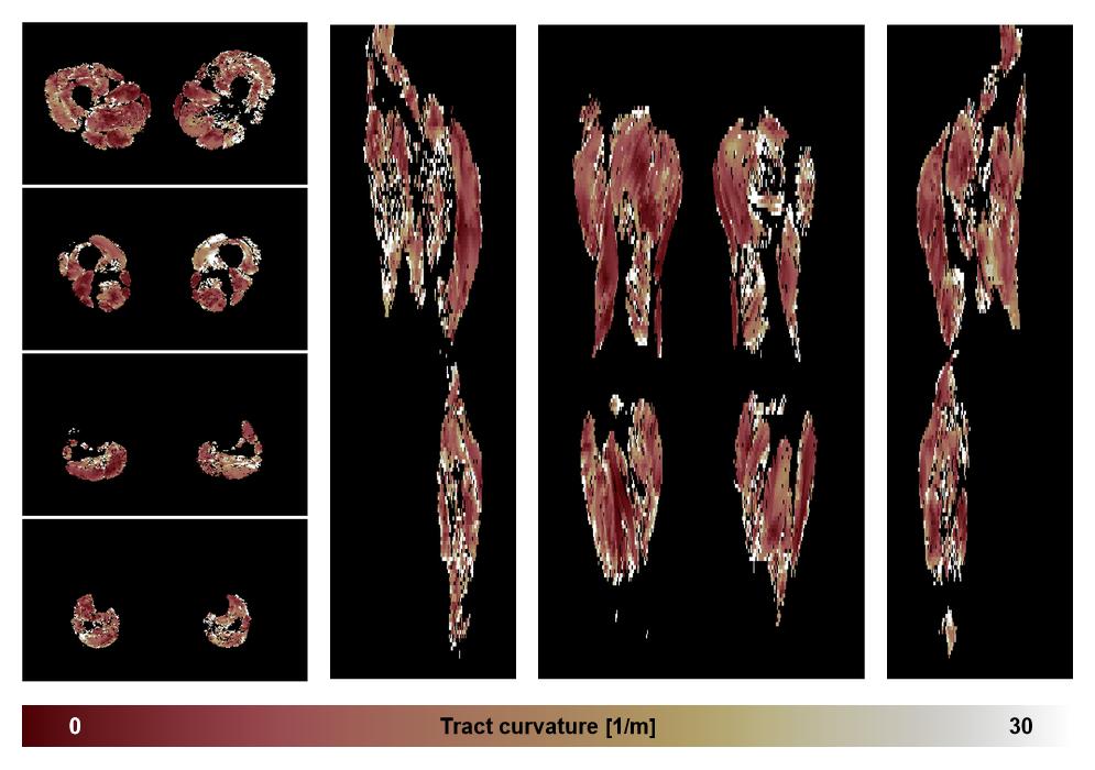 Muscle fiber tract curvature map based on whole leg DTI based fiber tractography.