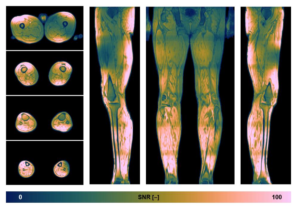 The SNR distribution of the dixon data.