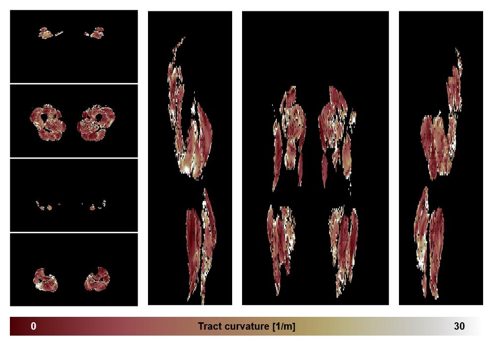Muscle fiber tract curvature map based on whole leg DTI based fiber tractography.