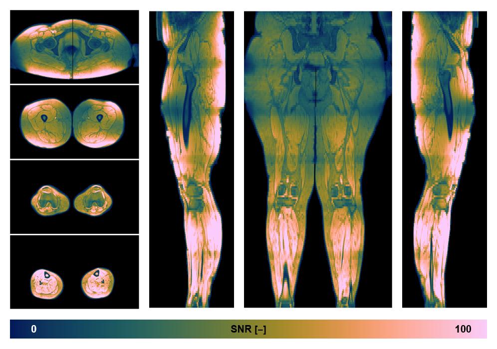 The SNR distribution of the dixon data.