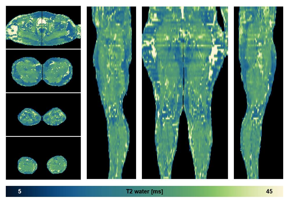 The water only T2 relaxation time of the lower extremity obtained from multi echo spin echo t2 mapping with EPG based reconstruction.
