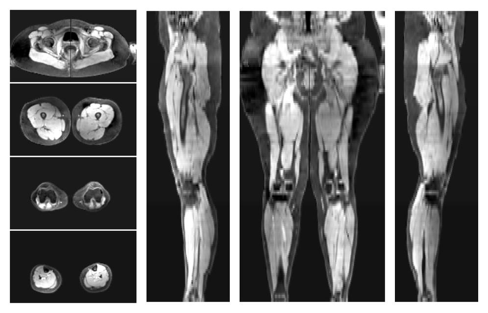 The water part of the acquired multi-echo spin echo data.