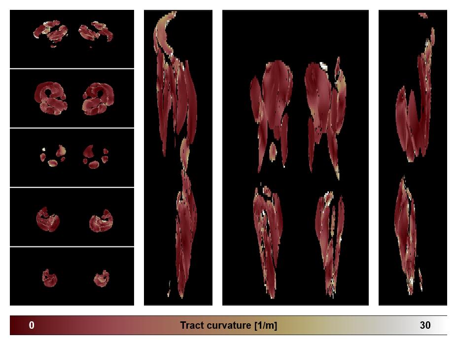 Muscle fiber tract curvature map based on whole leg DTI based fiber tractography.