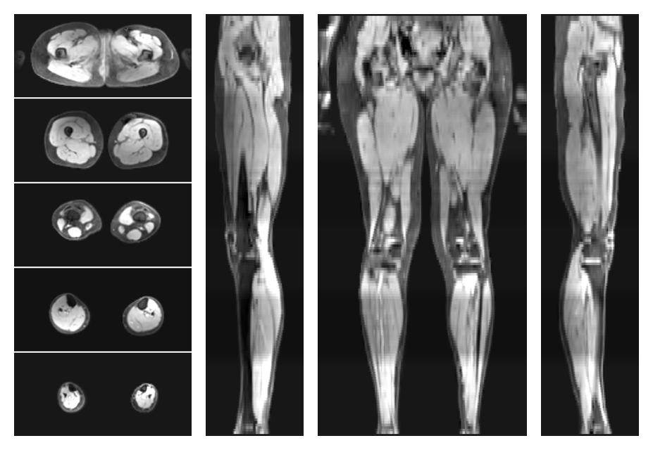 The water part of the acquired multi-echo spin echo data.