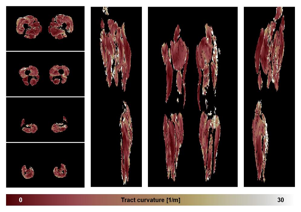 Muscle fiber tract curvature map based on whole leg DTI based fiber tractography.