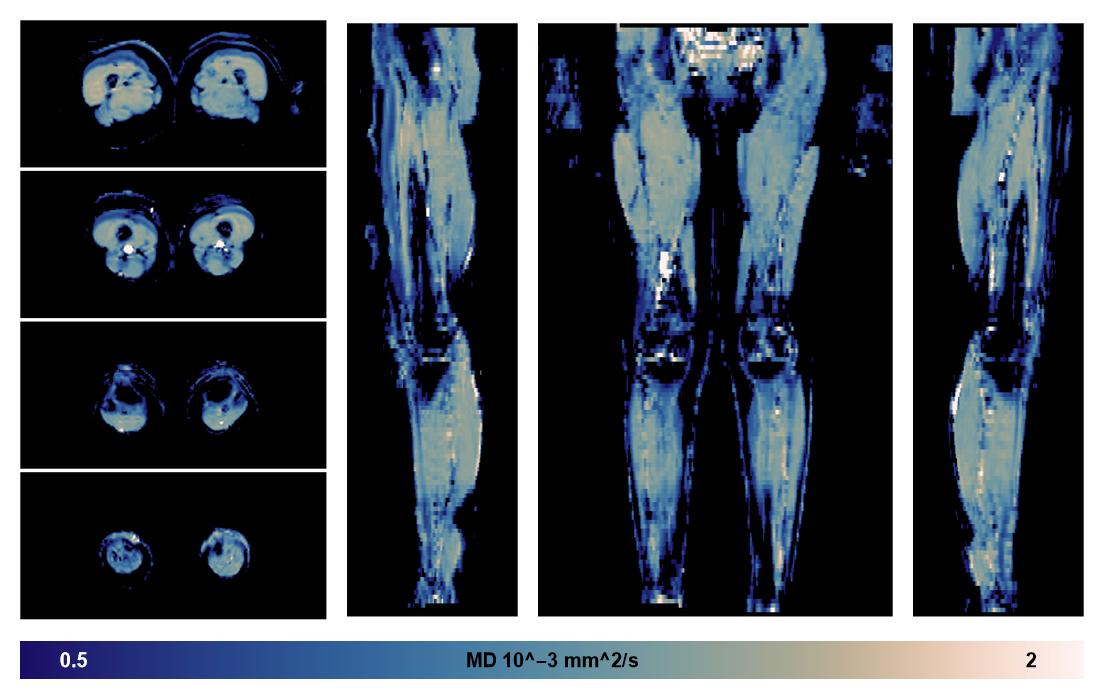 IVIM corrected whole leg muscle mean diffusivity obtained from diffusion tensor imaging.