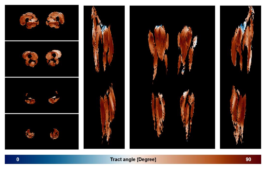 Muscle fiber tract angle map based on whole leg DTI based fiber tractography.