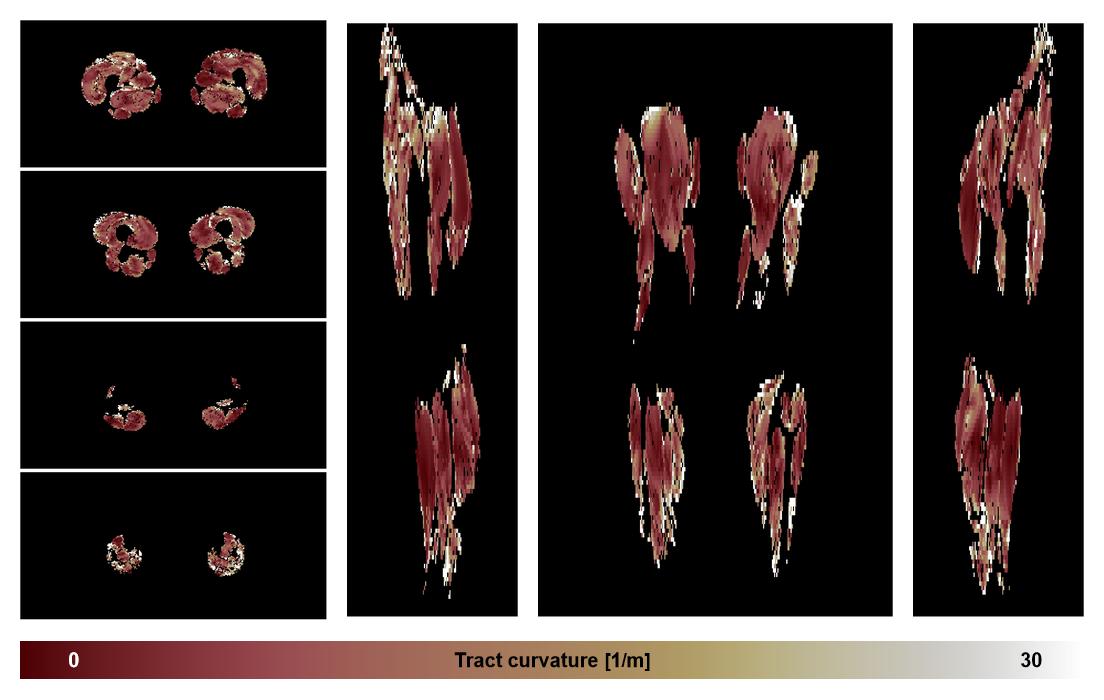 Muscle fiber tract curvature map based on whole leg DTI based fiber tractography.