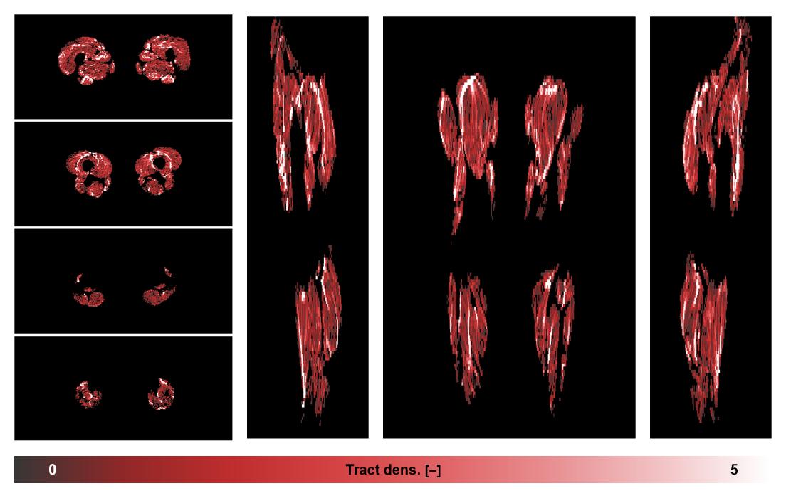Muscle fiber tract density map based on whole leg DTI based fiber tractography.