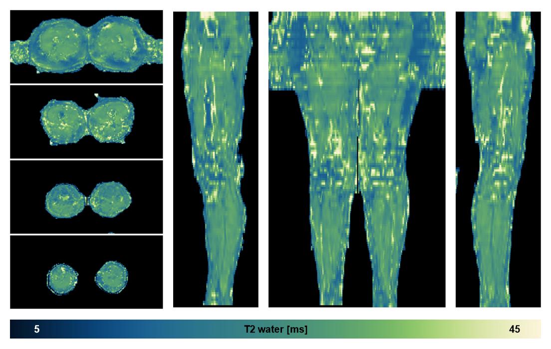 The water only T2 relaxation time of the lower extremity obtained from multi echo spin echo t2 mapping with EPG based reconstruction.