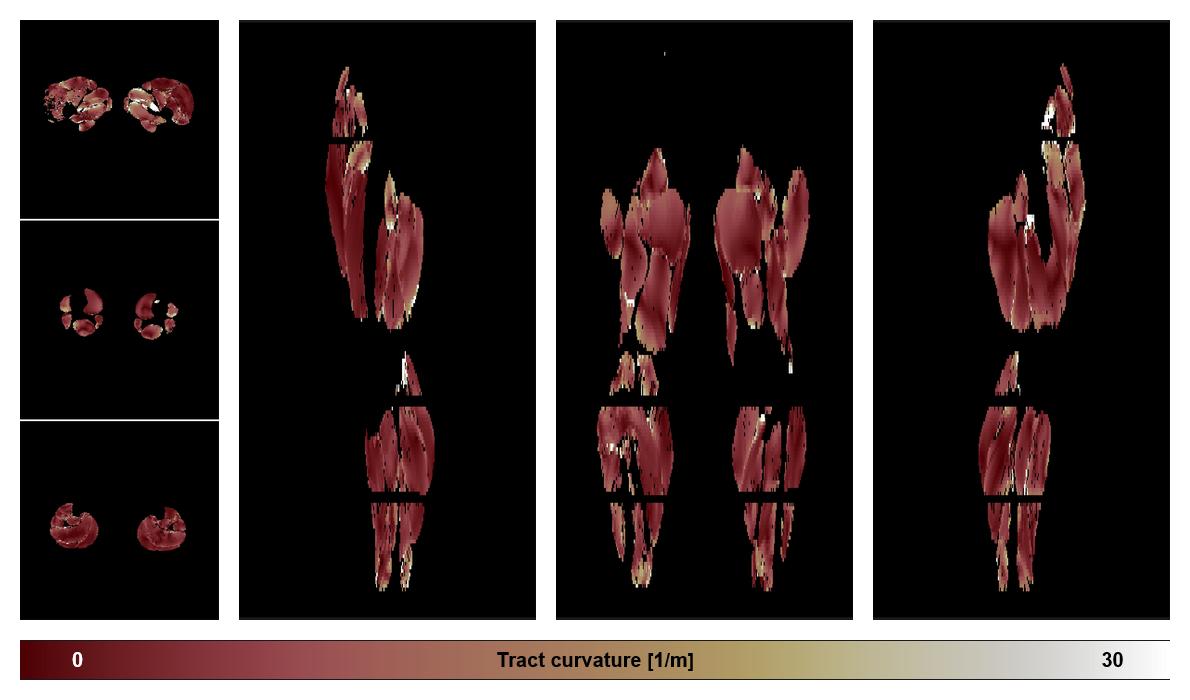 Muscle fiber tract curvature map based on whole leg DTI based fiber tractography.