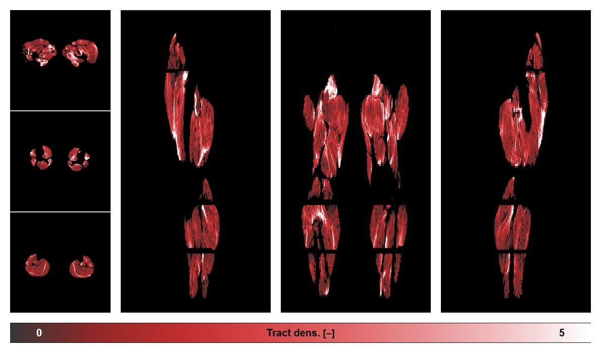 Muscle fiber tract density map based on whole leg DTI based fiber tractography.