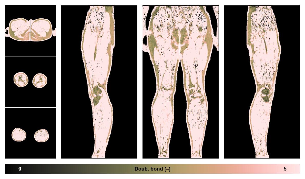 Number of double bonds in subcutanious fat.