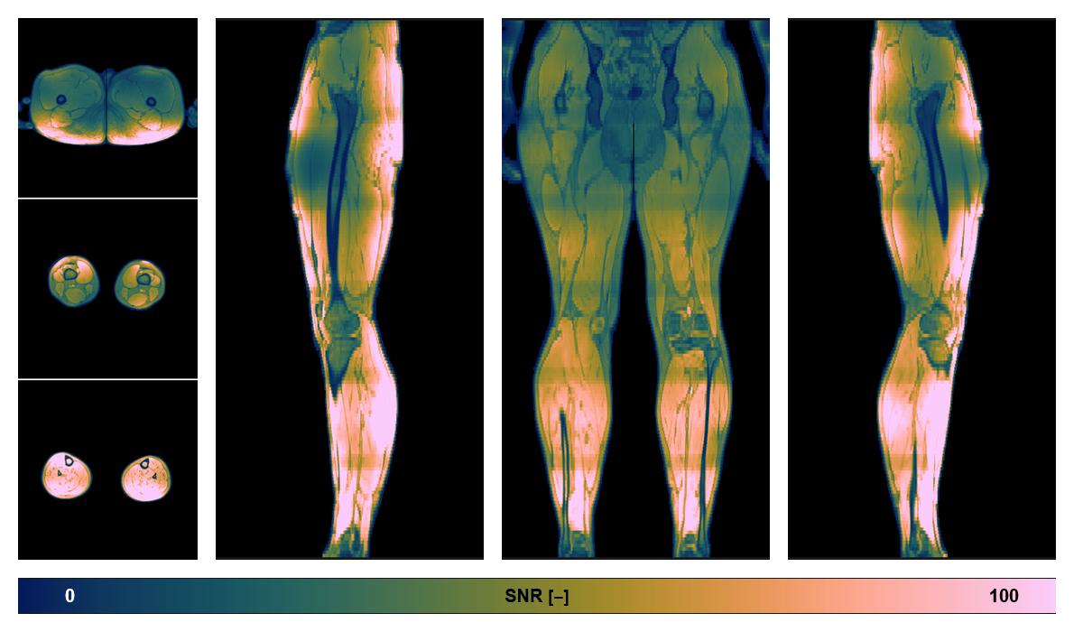 The SNR distribution of the dixon data.