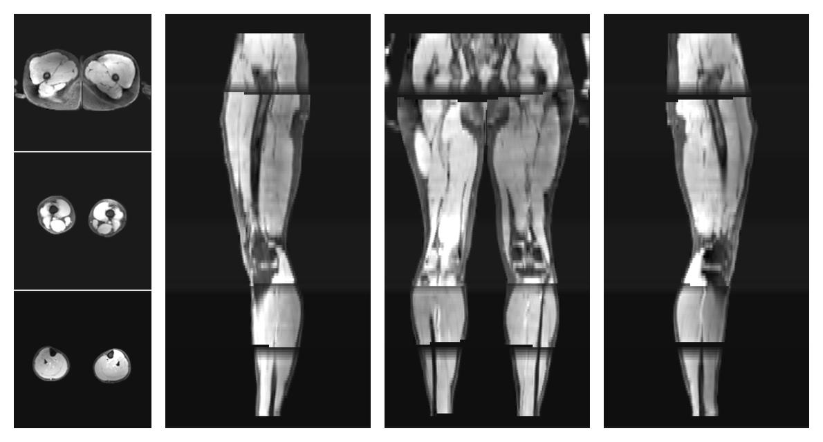 The water part of the acquired multi-echo spin echo data.