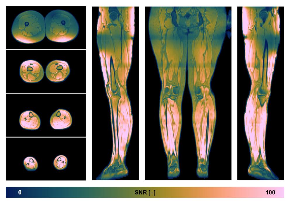 The SNR distribution of the dixon data.