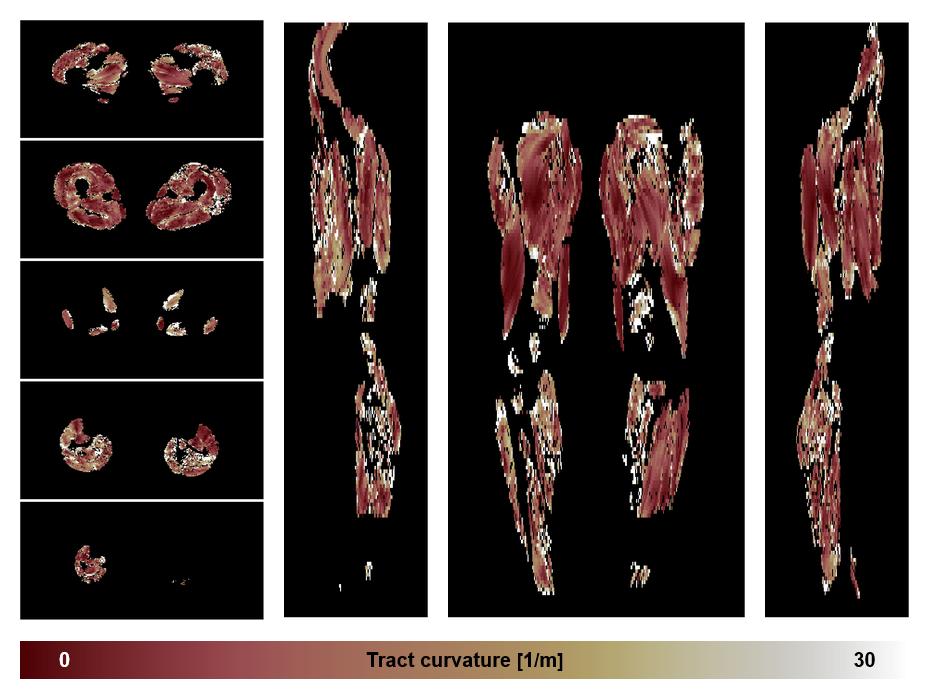 Muscle fiber tract curvature map based on whole leg DTI based fiber tractography.