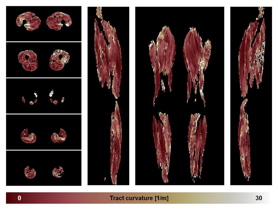 Muscle fiber tract curvature map based on whole leg DTI based fiber tractography.