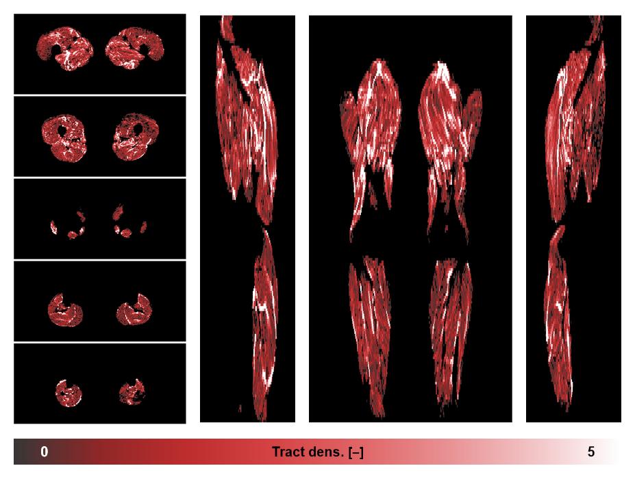 Muscle fiber tract density map based on whole leg DTI based fiber tractography.