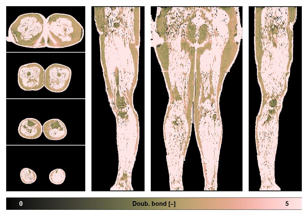 Number of double bonds in subcutanious fat.