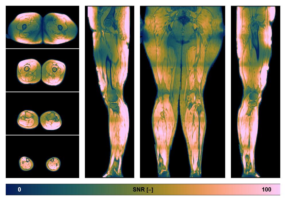 The SNR distribution of the dixon data.