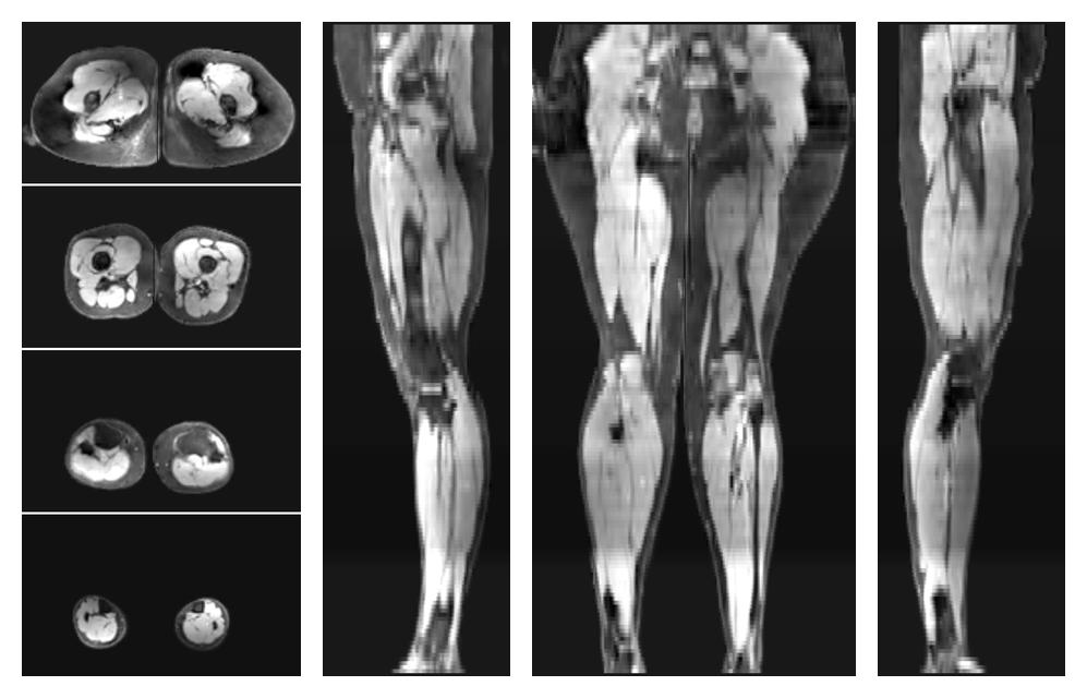 The water part of the acquired multi-echo spin echo data.
