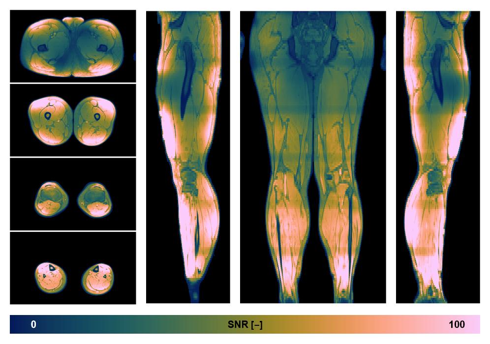 The SNR distribution of the dixon data.