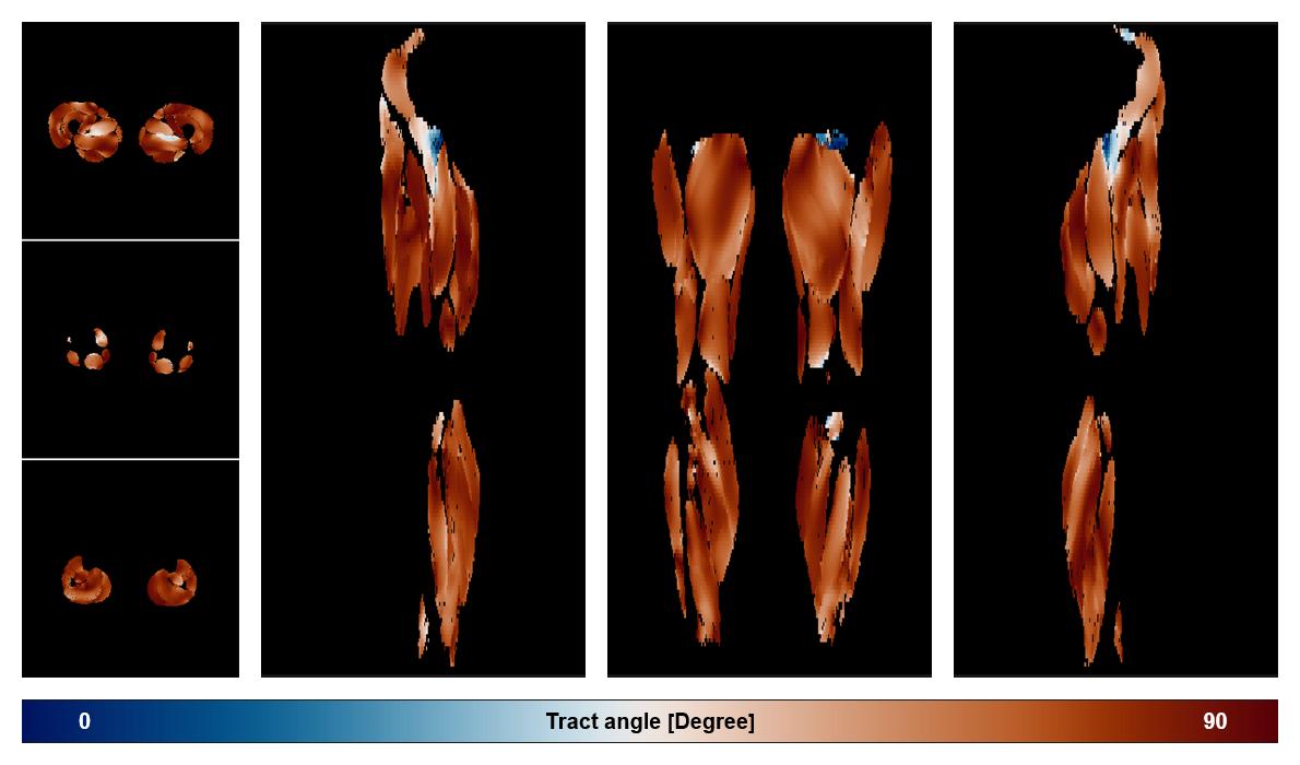 Muscle fiber tract angle map based on whole leg DTI based fiber tractography.