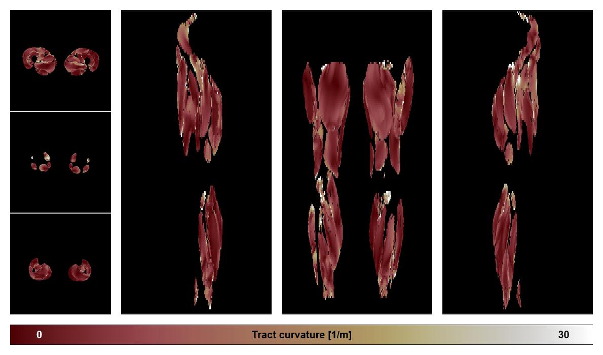 Muscle fiber tract curvature map based on whole leg DTI based fiber tractography.