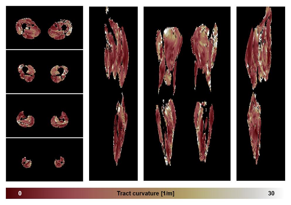 Muscle fiber tract curvature map based on whole leg DTI based fiber tractography.