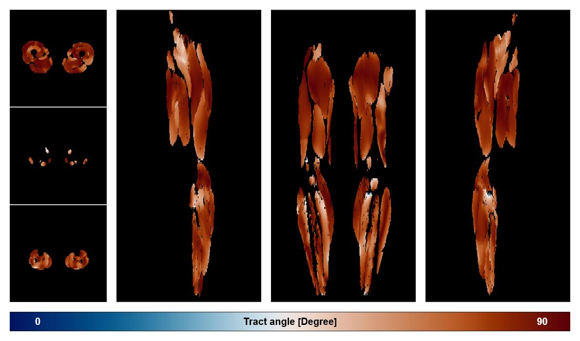 Muscle fiber tract angle map based on whole leg DTI based fiber tractography.