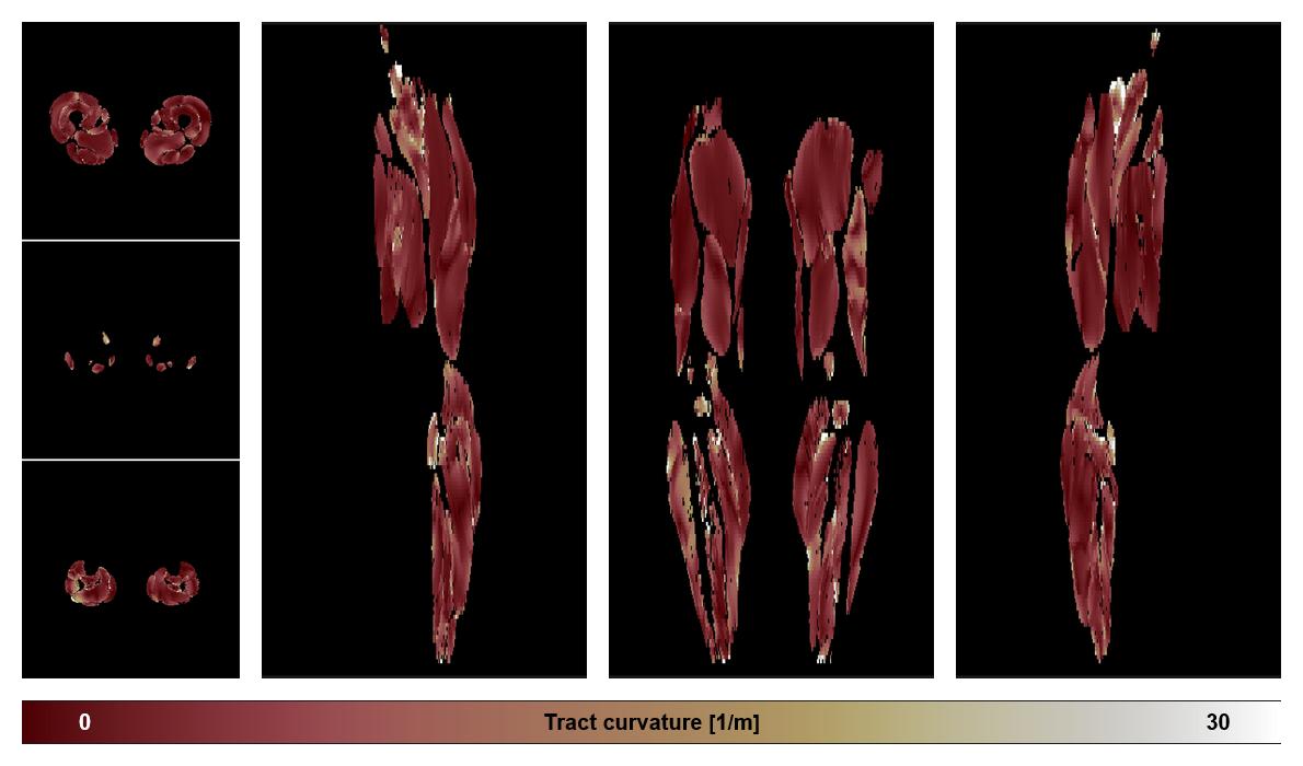 Muscle fiber tract curvature map based on whole leg DTI based fiber tractography.