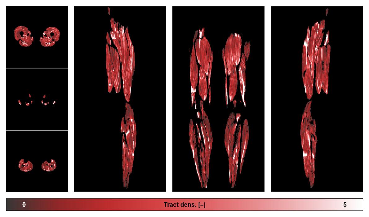 Muscle fiber tract density map based on whole leg DTI based fiber tractography.