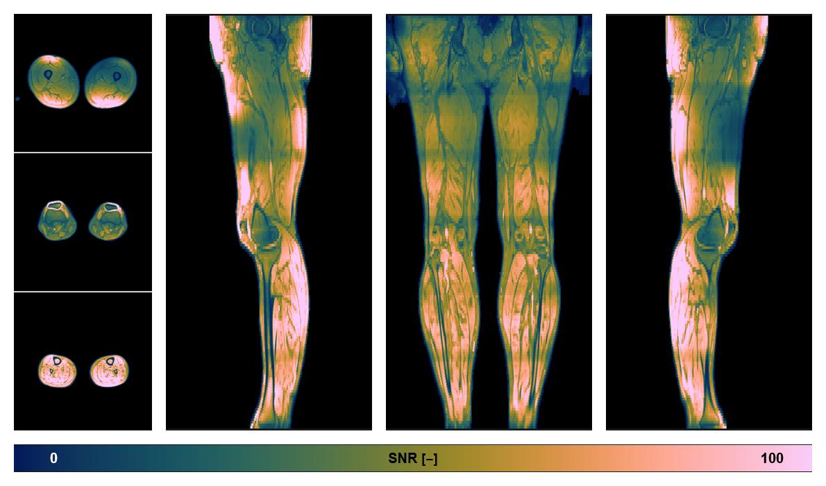 The SNR distribution of the dixon data.