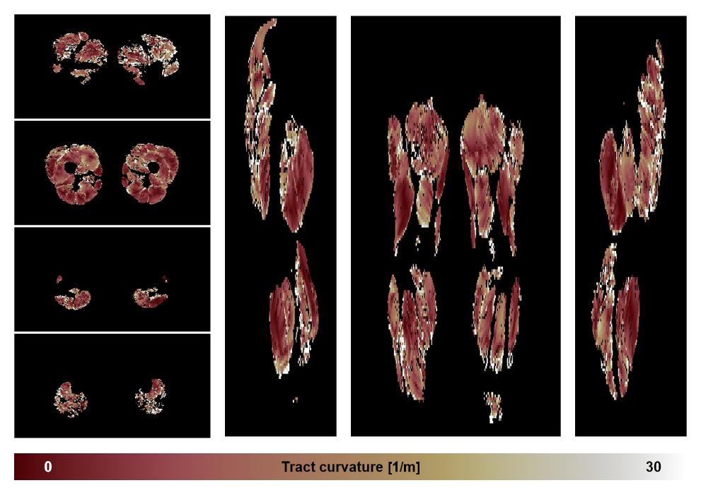 Muscle fiber tract curvature map based on whole leg DTI based fiber tractography.