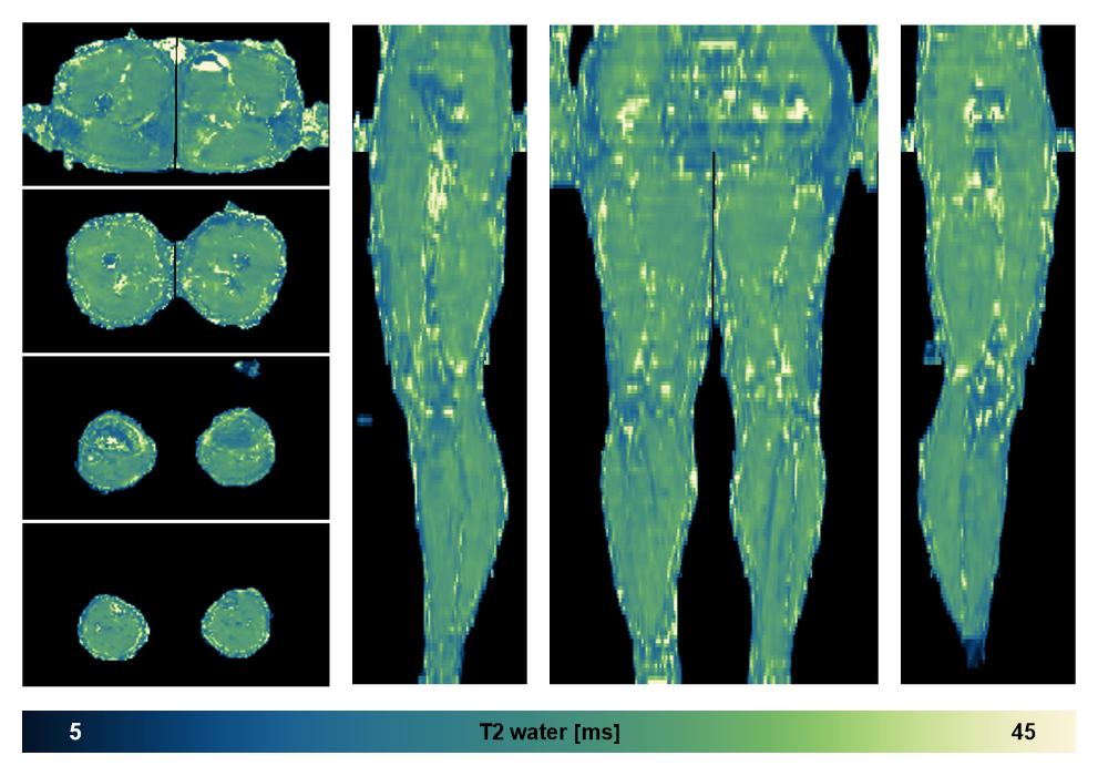 The water only T2 relaxation time of the lower extremity obtained from multi echo spin echo t2 mapping with EPG based reconstruction.