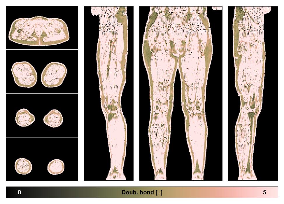Number of double bonds in subcutanious fat.