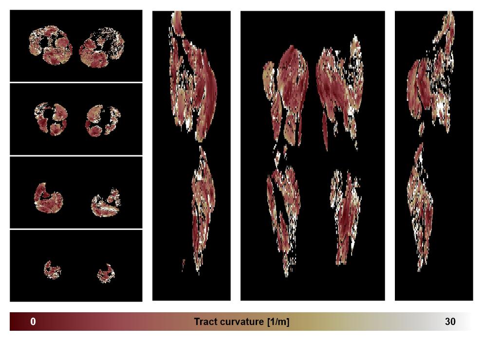 Muscle fiber tract curvature map based on whole leg DTI based fiber tractography.