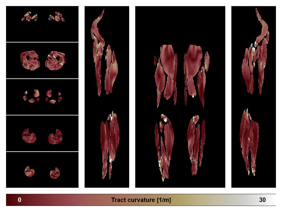 Muscle fiber tract curvature map based on whole leg DTI based fiber tractography.