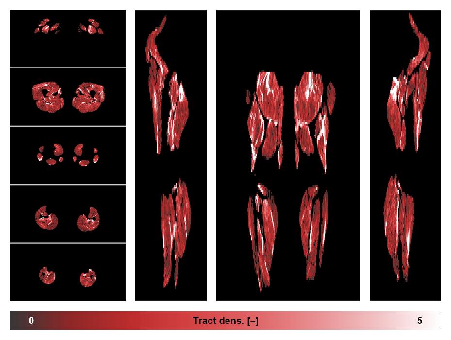 Muscle fiber tract density map based on whole leg DTI based fiber tractography.