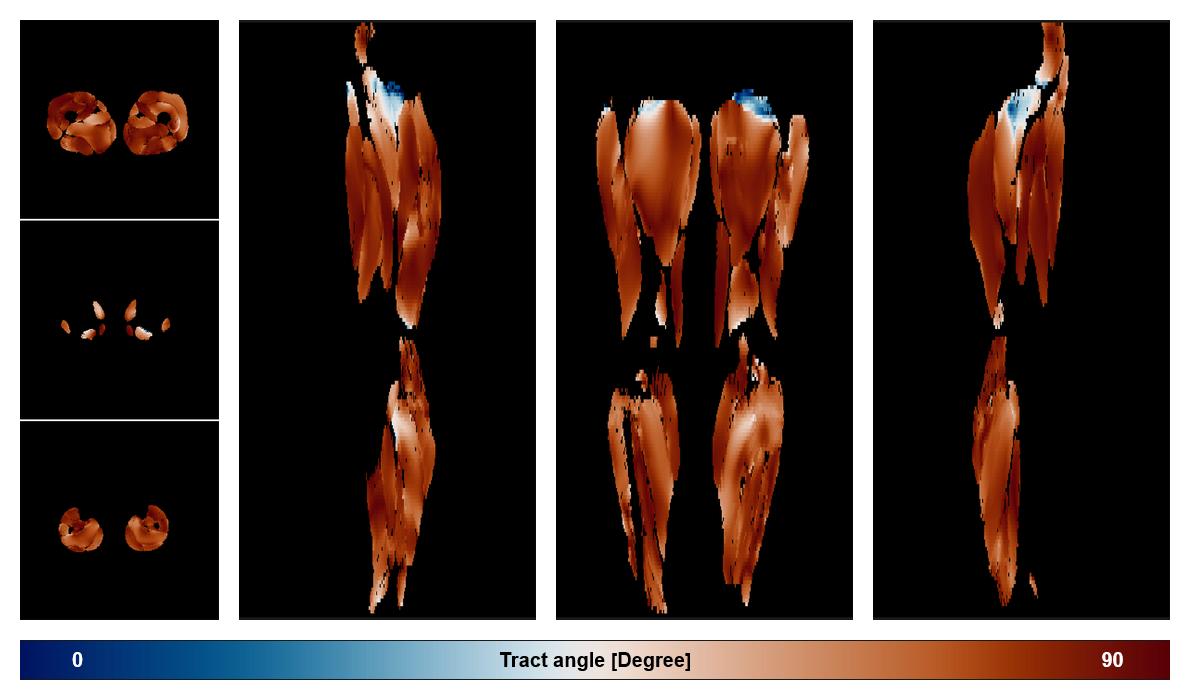 Muscle fiber tract angle map based on whole leg DTI based fiber tractography.