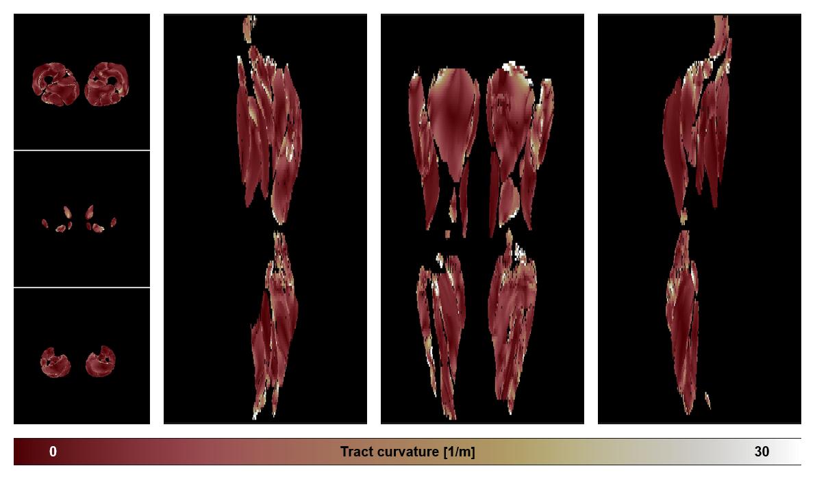 Muscle fiber tract curvature map based on whole leg DTI based fiber tractography.